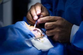 Sealing Lasik surgery